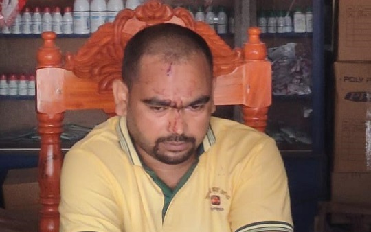 image-here